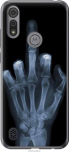 Чехол Рука через рентген для Motorola E6s