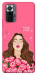 Чехол Kiss kiss для Xiaomi Redmi Note 10 Pro