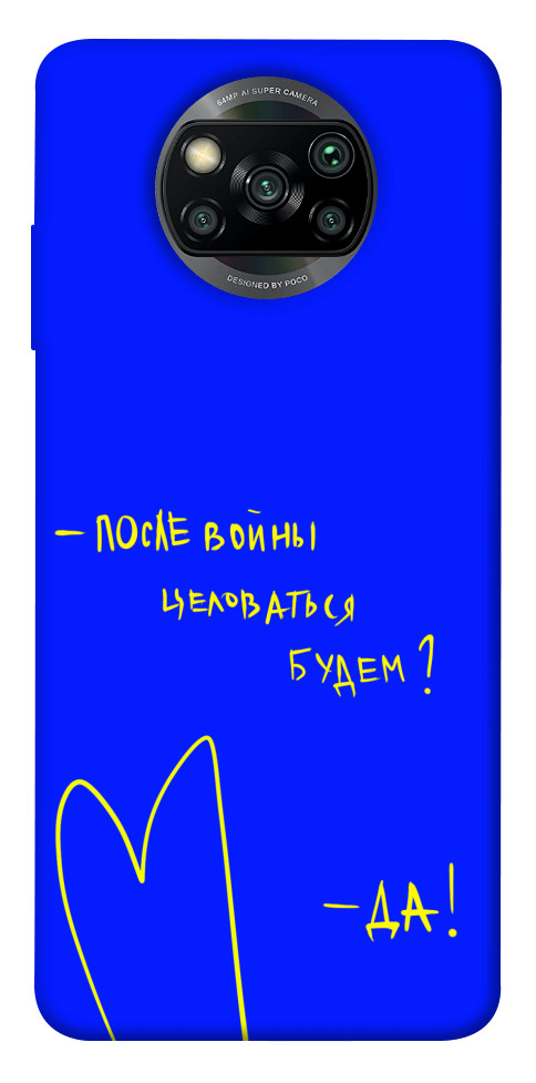 

Чохол Після війни для Xiaomi Poco X3 NFC 1312807