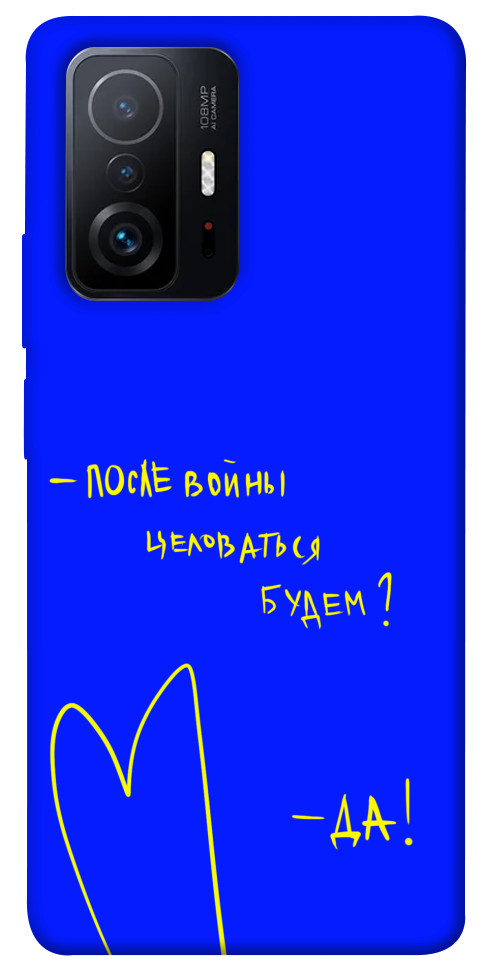 

Чохол Після війни для Xiaomi 11T 1312868