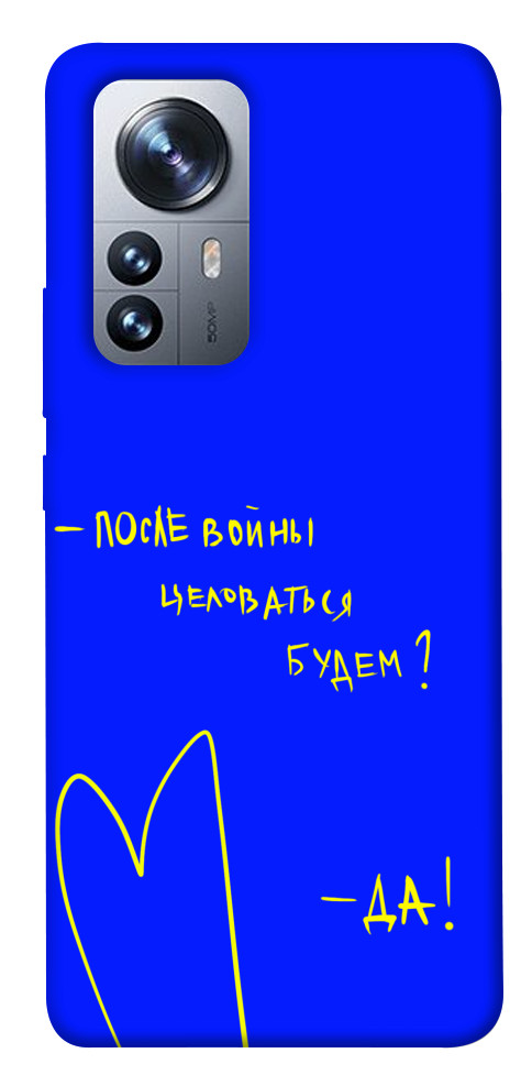 

Чохол Після війни для Xiaomi 12 1330337