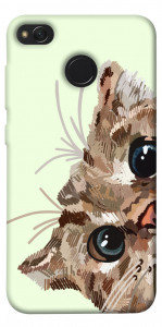 Чехол Cat muzzle для Xiaomi Redmi 4X