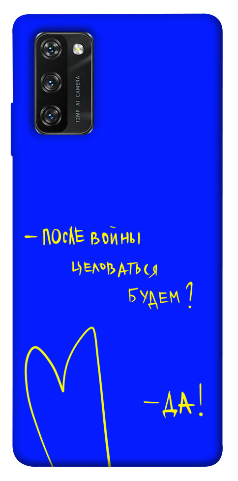 

Чохол Після війни для Blackview A100 1473820