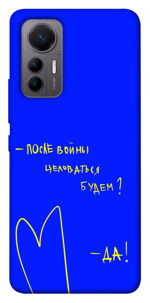 

Чохол Після війни для Xiaomi 12 Lite 1473824