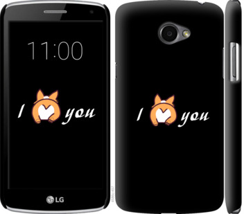 

Чехол Люблю для LG K5 X220 805361