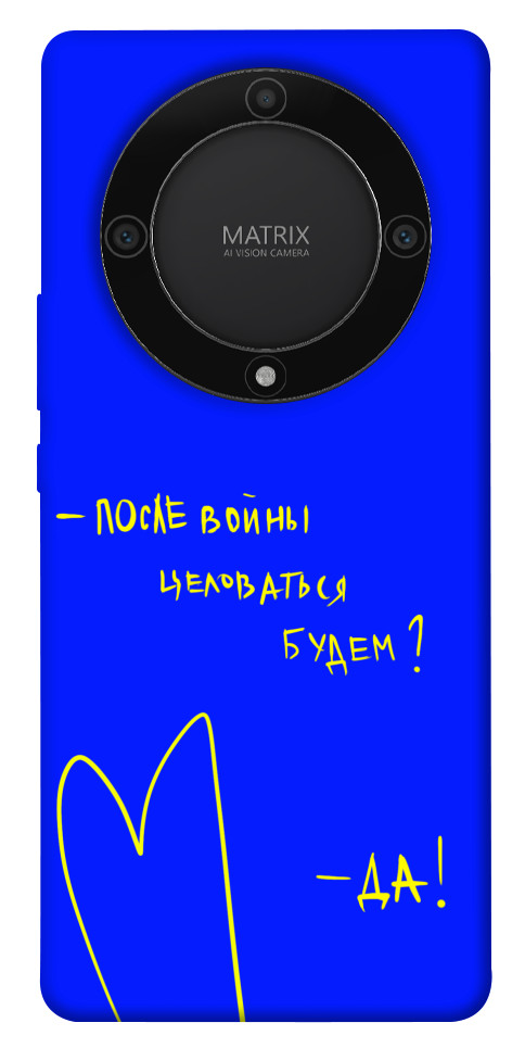 

Чохол Після війни для Huawei Magic5 Lite 1657276