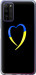 Чохол на Huawei Honor 30 Lite Жовто-блакитне серце 885u-2074 (Чорний)