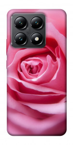 Чехол Pink bud для Xiaomi 14T