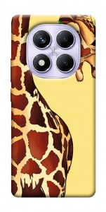 Чохол Cool giraffe для Xiaomi Redmi Note 14 Pro 4G