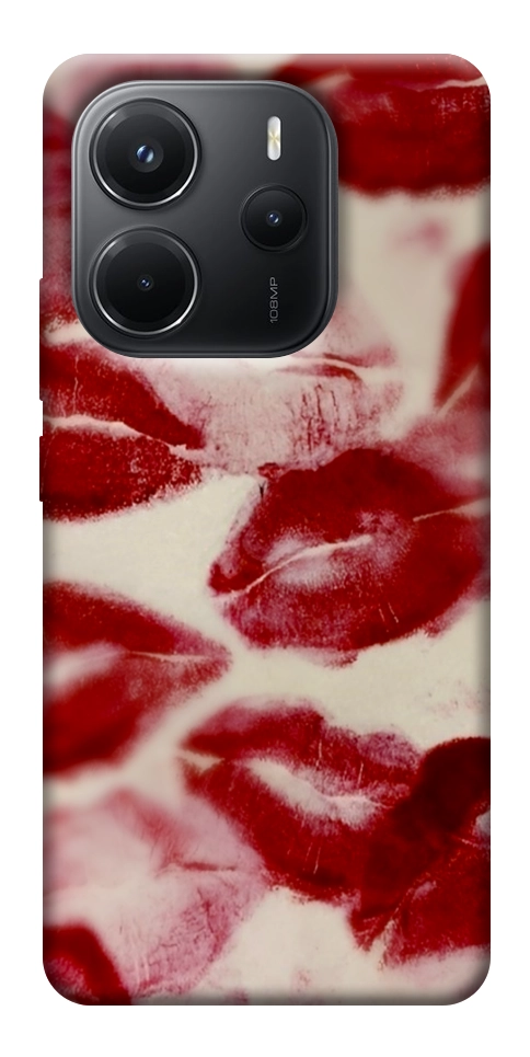 Чехол Kisses для Xiaomi Redmi Note 14 4G (Europe version)