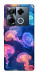 Чохол Neon jellyfishes для Infinix Note 40 Pro 4G