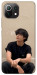 Чехол BTS V для Xiaomi Mi 11 Lite