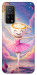 Чохол Ballerina illustration для Xiaomi Mi 10T