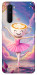 Чохол Ballerina illustration для OnePlus Nord