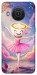 Чохол Ballerina illustration для Nokia X20