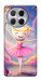 Чохол Ballerina illustration для TECNO Camon 30 (CL6)