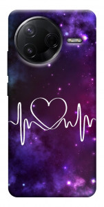 Чохол Кардіограма для Xiaomi Poco F7 Pro
