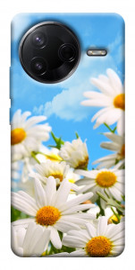 Чехол Ромашковое поле для Xiaomi Poco F7 Pro