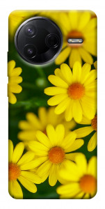 Чехол Yellow chamomiles для Xiaomi Poco F7 Pro
