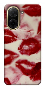 Чохол Kisses для Xiaomi Redmi A5 (Europe version)