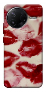 Чохол Kisses для Xiaomi Poco F7 Pro