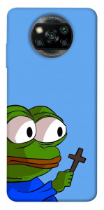 Чохол Pepe frog для Xiaomi Poco X3 NFC