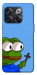 Чохол Pepe frog для OnePlus 10T