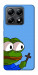 Чехол Pepe frog для Xiaomi 14T