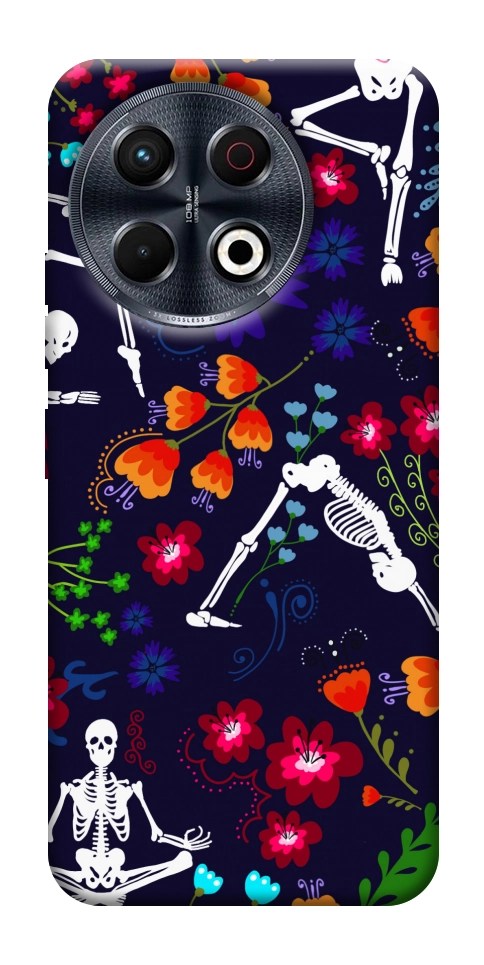 Чохол Yoga skeletons для TECNO Spark 30 Pro (KL7)