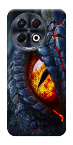 Чохол Snake eye для TECNO Spark 30 Pro (KL7)