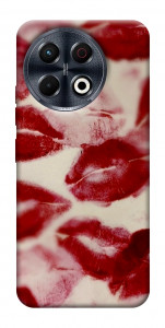 Чохол Kisses для TECNO Spark 30 Pro (KL7)