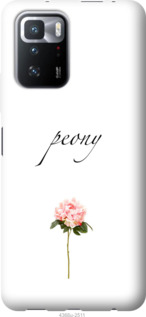 

Чехол Пион для Xiaomi Poco X3 GT 1229499