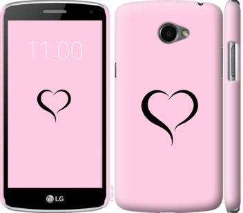 

Чехол Сердце 1 для LG K5 X220 899457