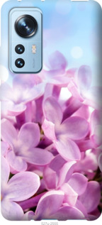 

Чохол Бузок для Xiaomi 12 1568107