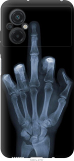 

Чохол Рука через рентген на Xiaomi Poco M5 1579698