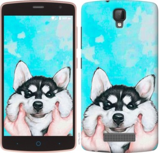 

Чехол Улыбнись для ZTE L5 720350