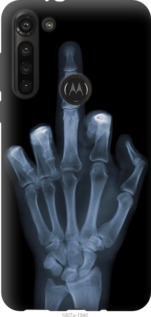 

Чохол Рука через рентген на Motorola G8 Power 1579871