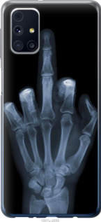 

Чохол Рука через рентген на Samsung Galaxy M31s M317F 1579752