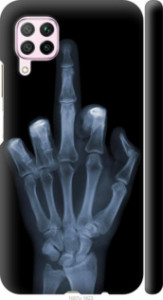Чехол Рука через рентген для Huawei P40 Lite