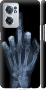 Чехол Рука через рентген для OnePlus Nord CE 2