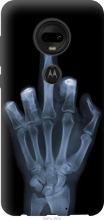 

Чехол Рука через рентген для Motorola Moto G7 1001720