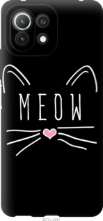 

Чехол Kitty для Xiaomi Mi 11 Lite 1167957
