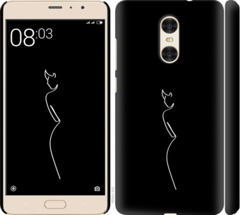 

Чехол Силуэт1 для Xiaomi Redmi Pro 809659