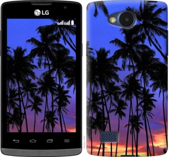 

Чехол Пальмы для LG Joy H220 759095