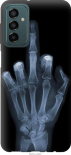 

Чохол Рука через рентген на Samsung Galaxy M23 M236B 1579750
