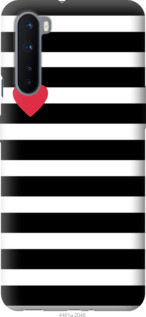 

Чехол Черно-белые полосы для OnePlus Nord 1085455