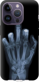 

Чохол Рука через рентген на iPhone 14 Pro 1567351