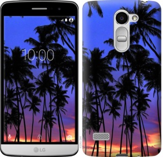

Чехол Пальмы для LG X190 759093