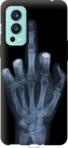 Чехол Рука через рентген для OnePlus Nord 2