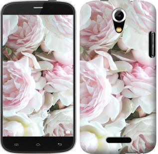 

Чохол Півонії v2 на Doogee Y100X 632564